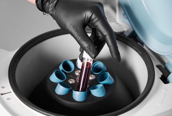 preparation-blood-injections-cosmetologist-puts-tube-blood-centrifuge 3